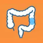 Colorectal Disease